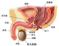 尿道上裂该怎么办